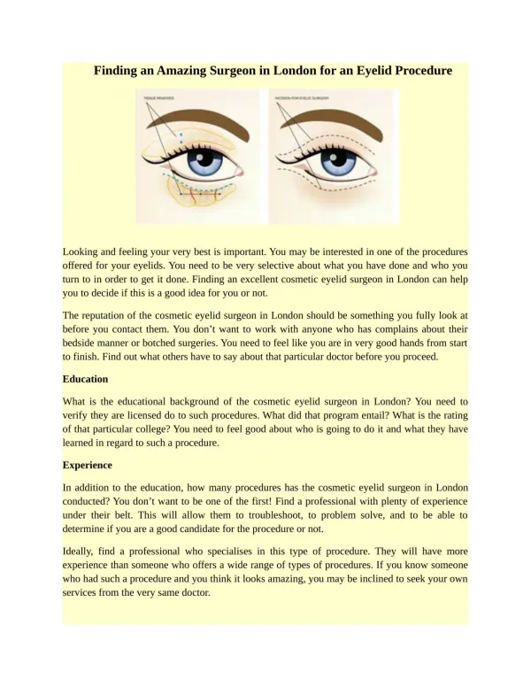 Finding an Amazing Surgeon in London for an Eyelid Procedure