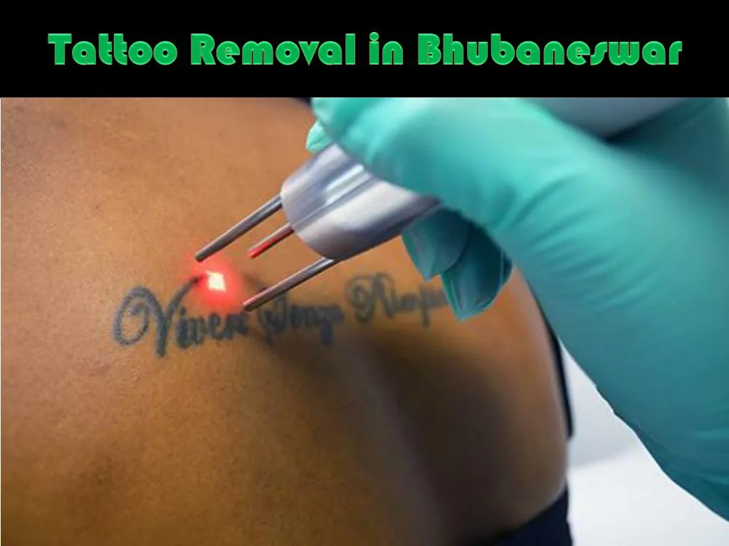 tattoo removal in bhubaneswar