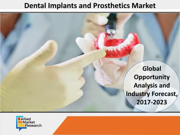 Dental Implants and Prosthetics Market to Reach $12,743 Mn by 2023