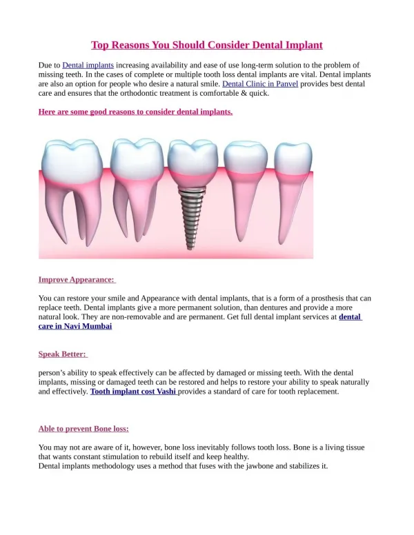 Top Reasons You Should Consider Dental Implant