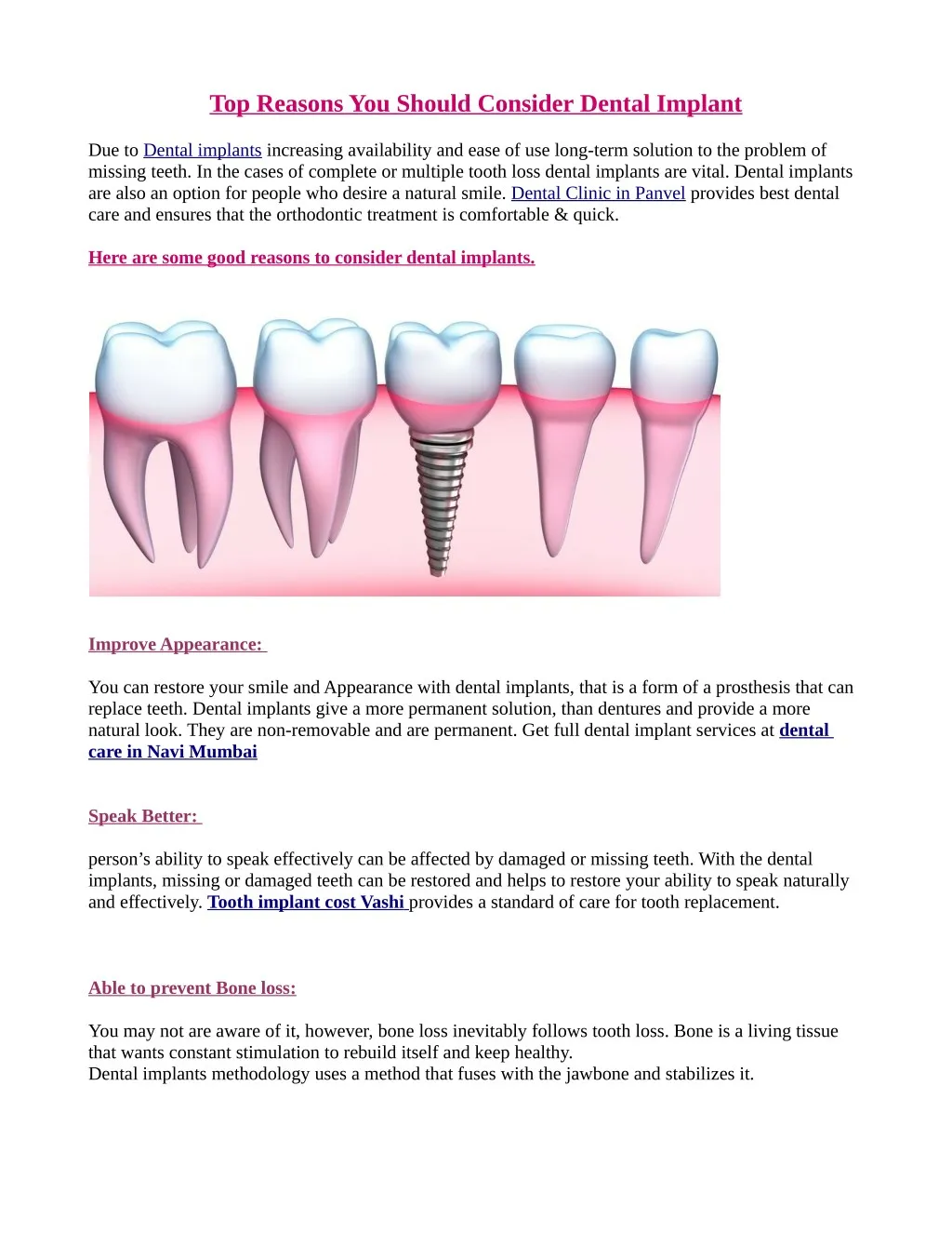 top reasons you should consider dental implant