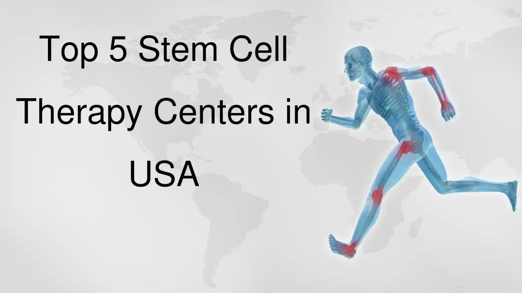 top 5 stem cell therapy centers in usa