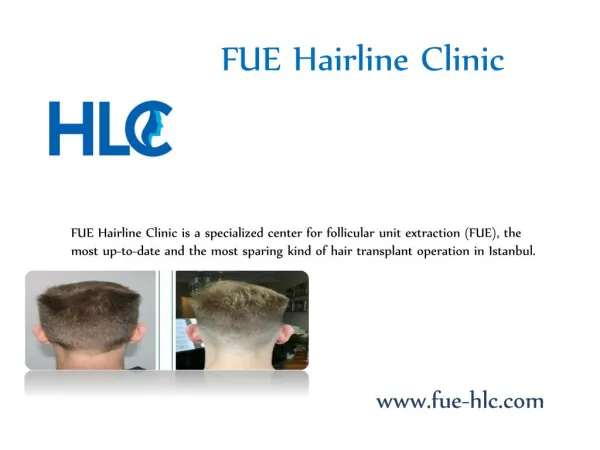 FUE Hairline Clinic