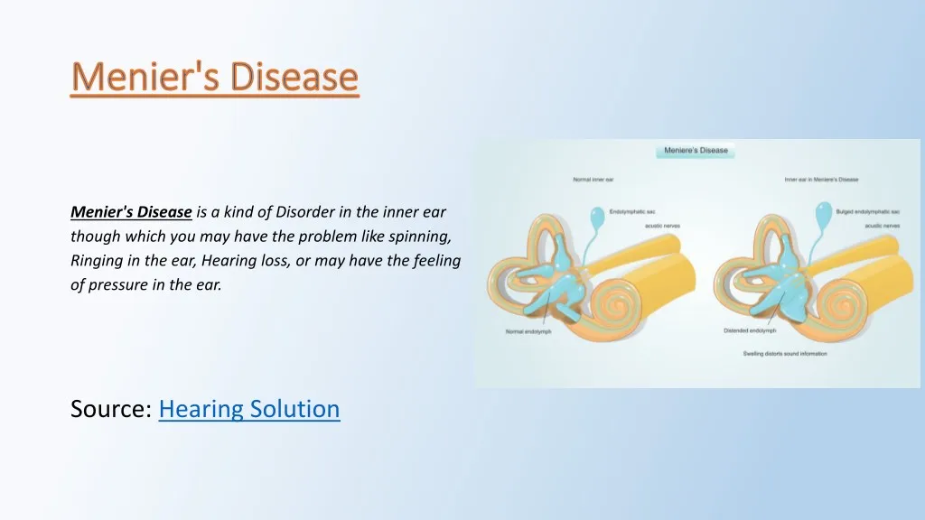menier s disease is a kind of disorder