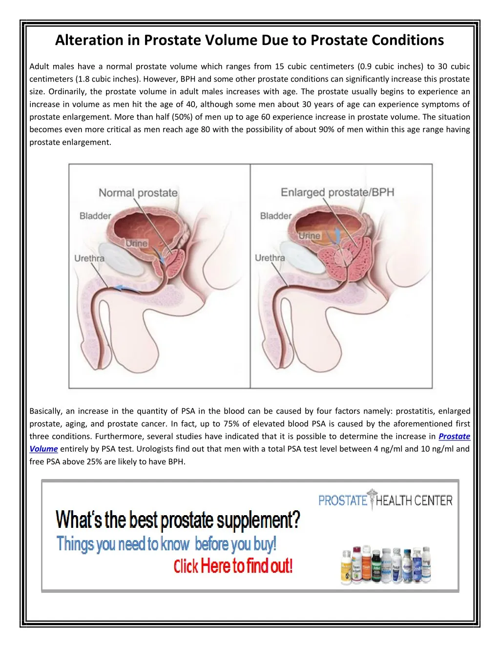 alteration in prostate volume due to prostate