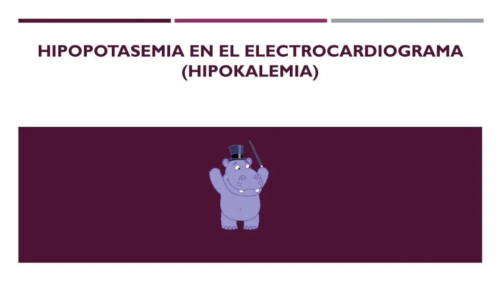 hipopotasemia en el electrocardiograma hipokalemia