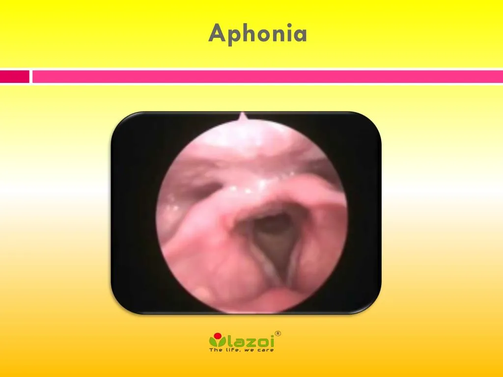 aphonia