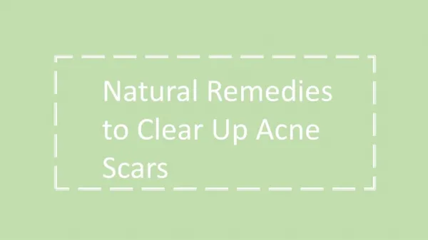 Natural Remedies to Clear Up Acne Scars