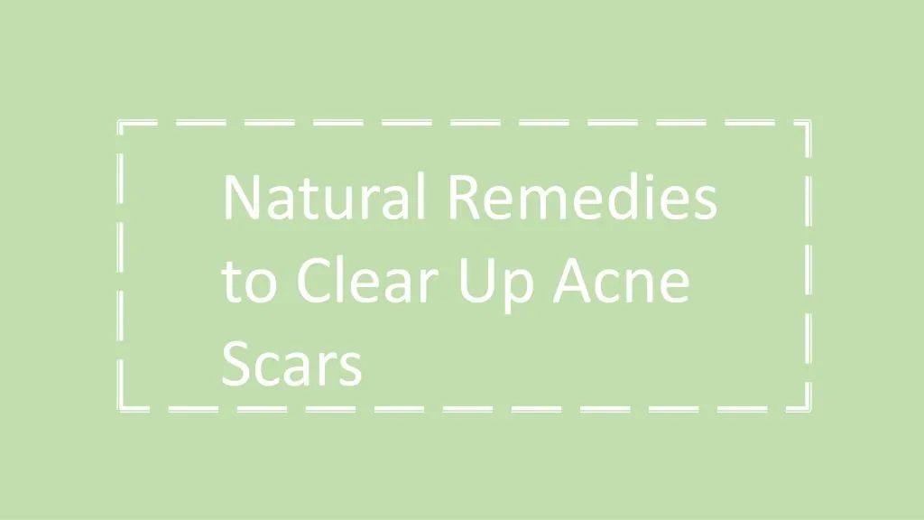 natural remedies to clear up acne scars