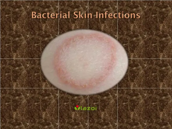 Bacterial Skin Infections : Causes, Symptoms, Treatment and Diagnosis