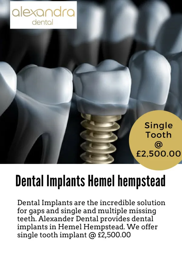 Dental Implants Hemel hempstead
