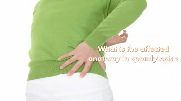 What is the affected anatomy in spondylosis ?