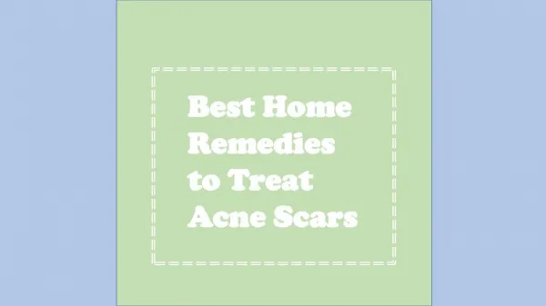 Best Home Remedies to Treat Acne Scars