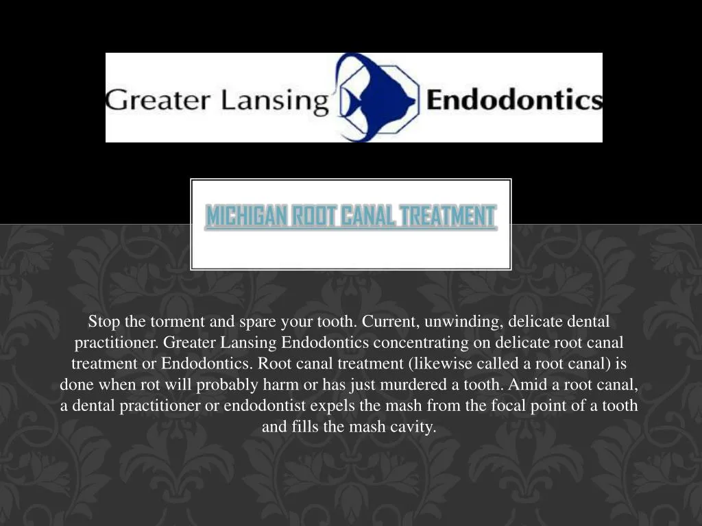 michigan root canal treatment