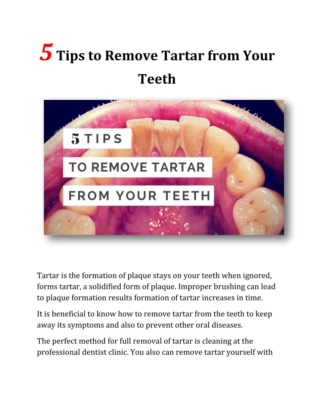 5 tips to remove tartar from your teeth
