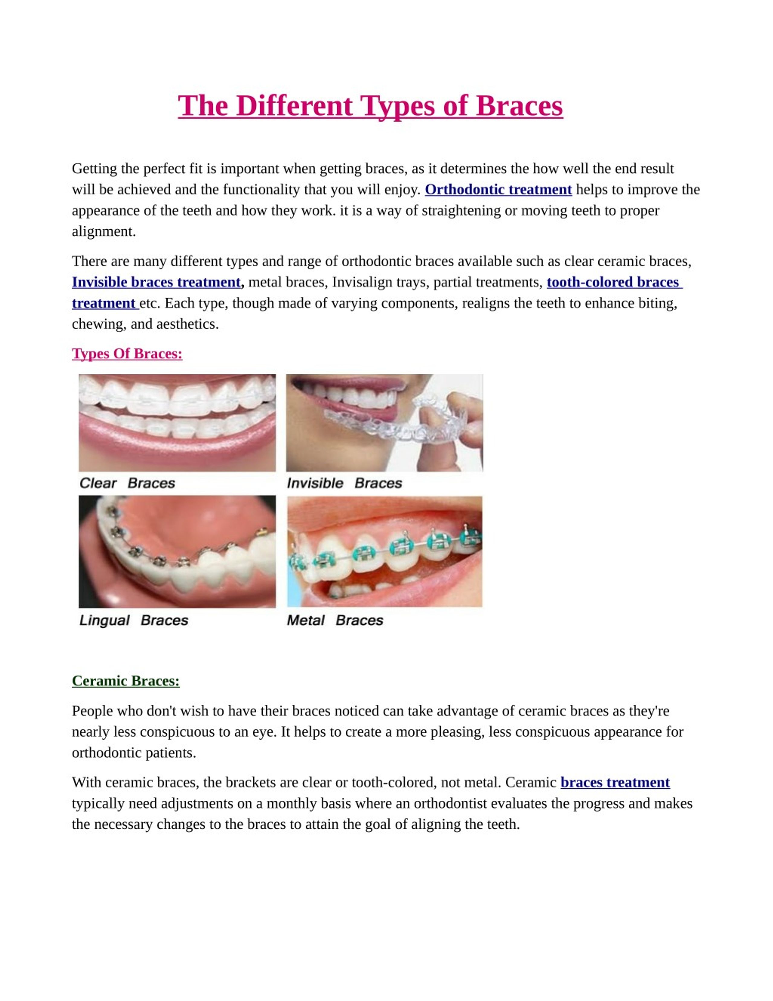 PPT - The Different Types of Braces PowerPoint Presentation, free ...