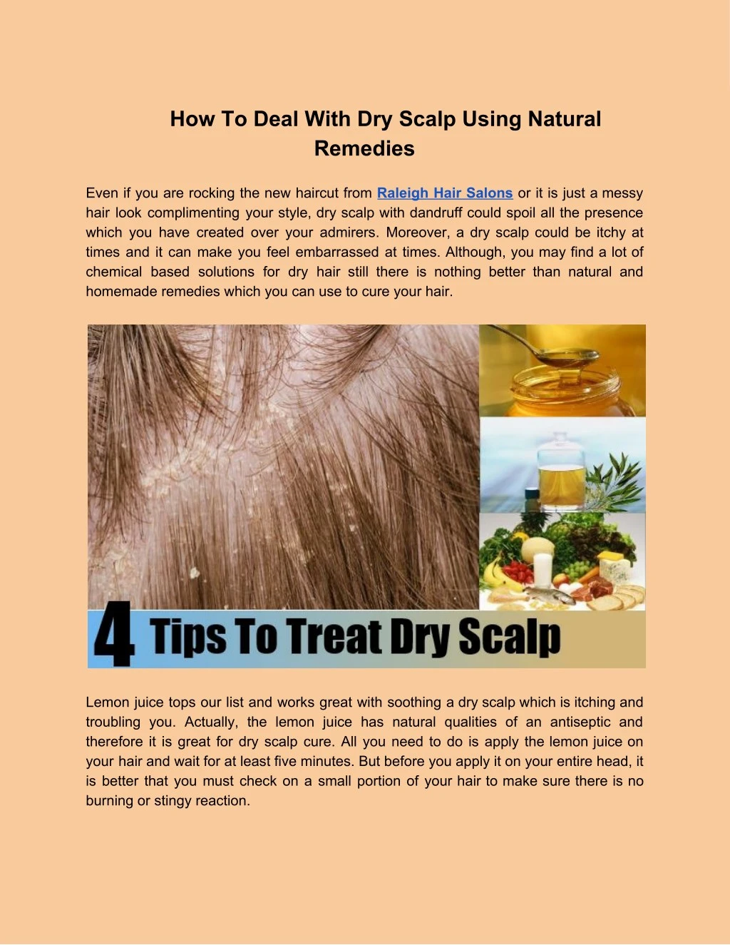 how to deal with dry scalp using natural remedies