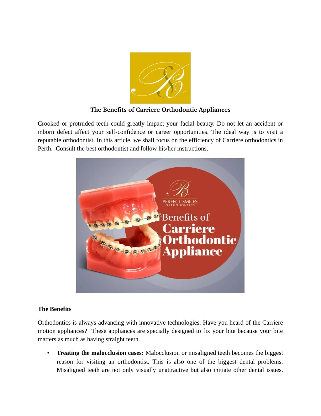 the benefits of carriere orthodontic appliances