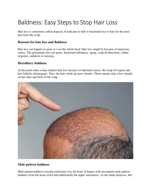 Baldness: Easy Steps to Stop Hair Loss
