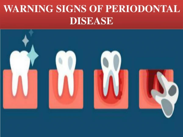 WARNING SIGNS OF PERIODONTAL DISEASE