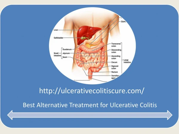 Online Ayurvedic Treatment for Ulcerative Colitis with Free Consultation
