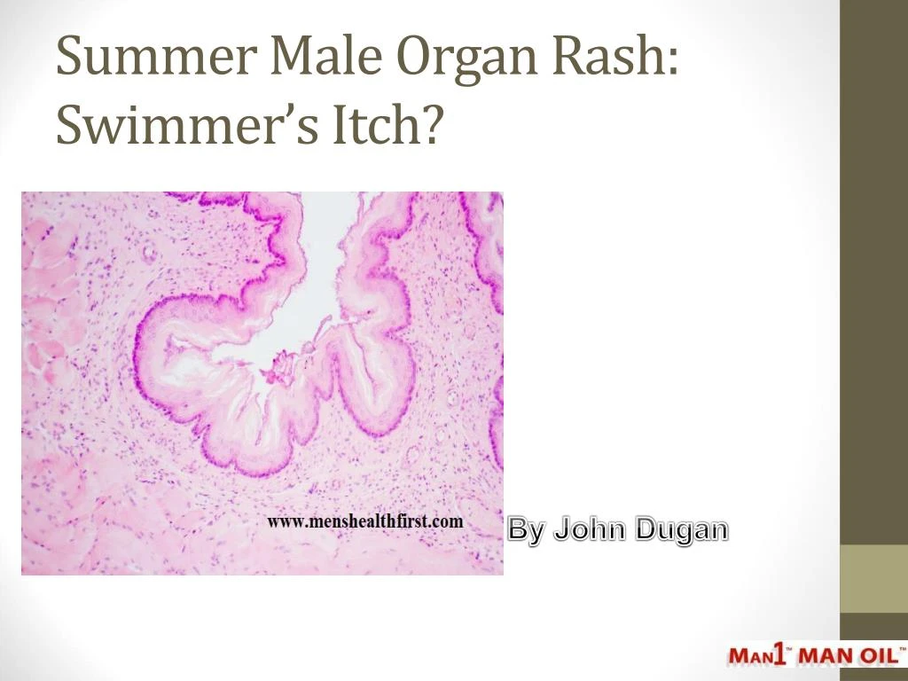 summer male organ rash swimmer s itch