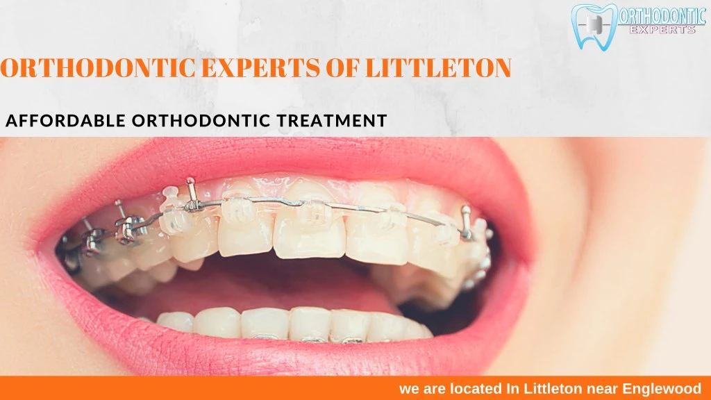 orthodontic experts of littleton