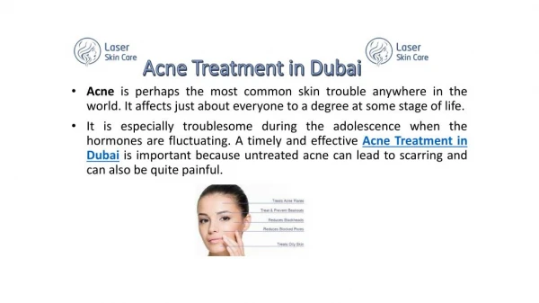 Acne treatment in Dubai