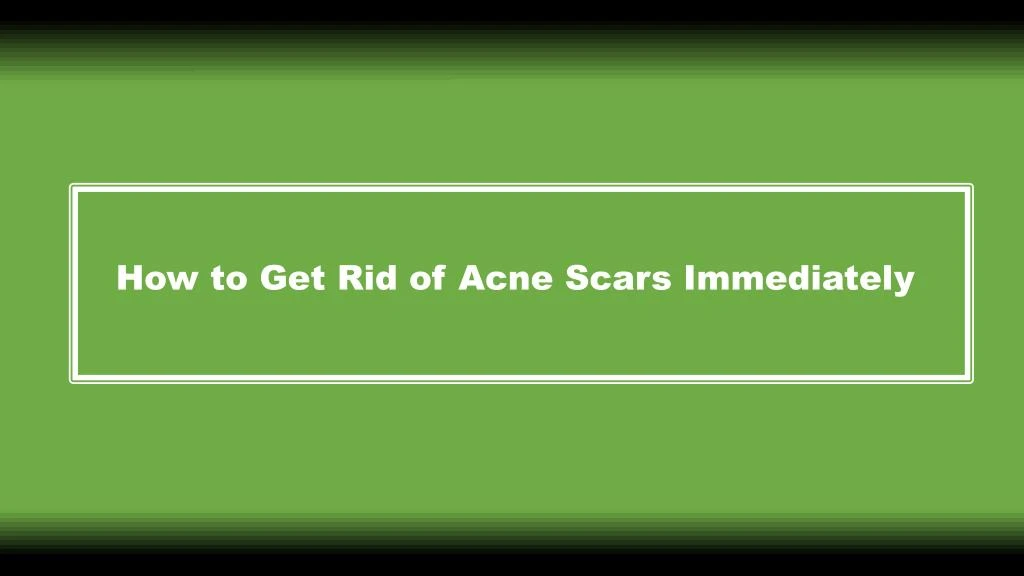 how to get rid of acne scars immediately