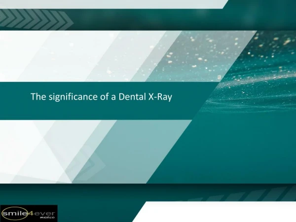 The significance of a Dental X-Ray