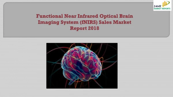 Functional Near Infrared Optical Brain Imaging System (fNIRS) Sales Market Report 2018