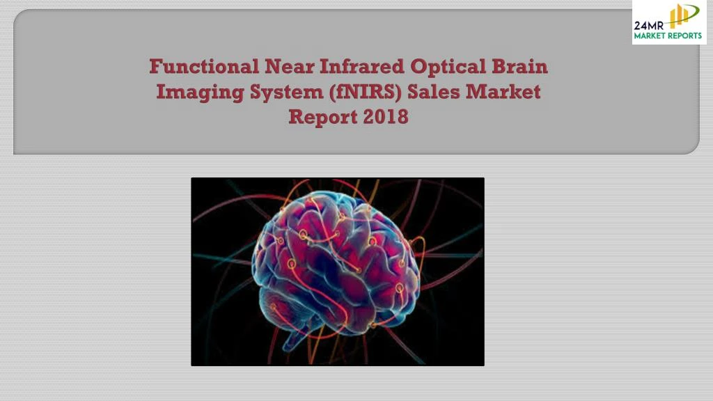 functional near infrared optical brain imaging system fnirs sales market report 2018