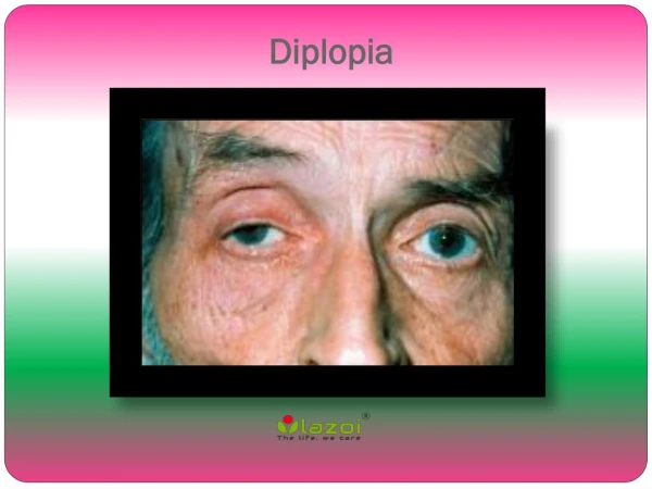 Diplopia