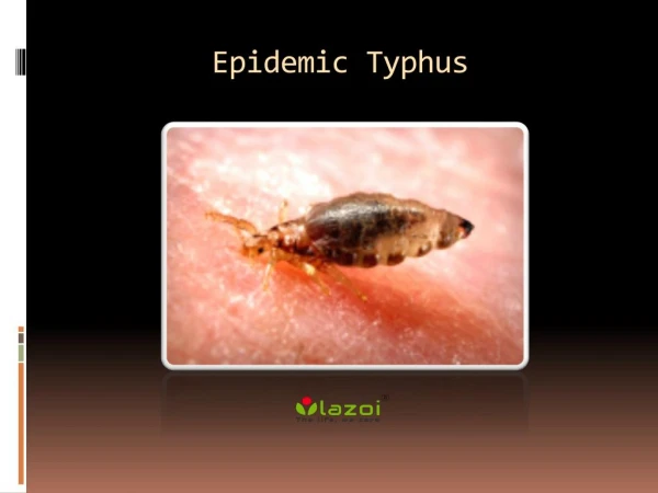 Epidemic Typhus