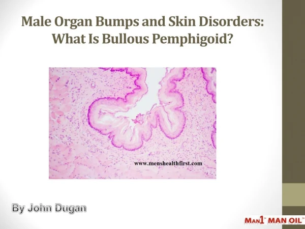 Male Organ Bumps and Skin Disorders: What Is Bullous Pemphigoid?