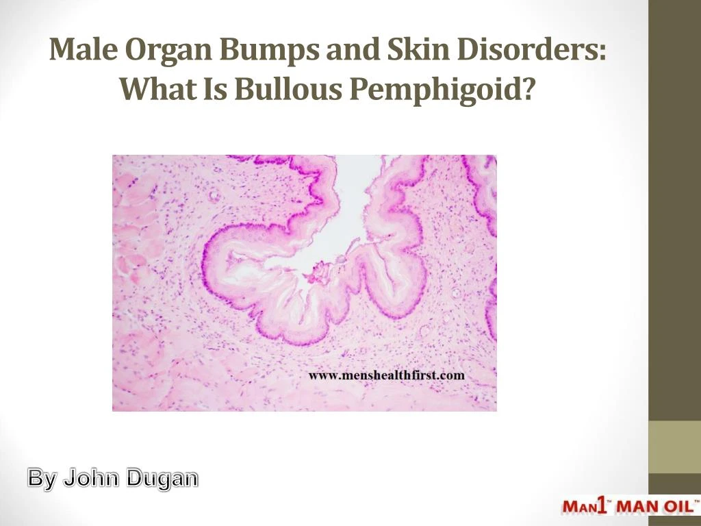 male organ bumps and skin disorders what is bullous pemphigoid