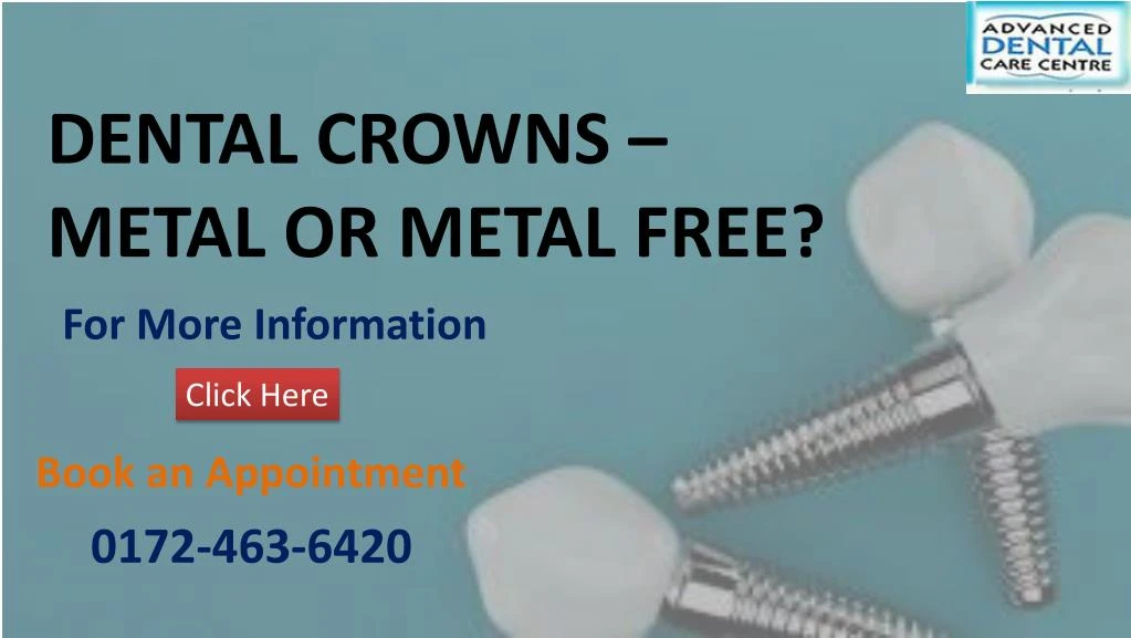 dental crowns metal or metal free