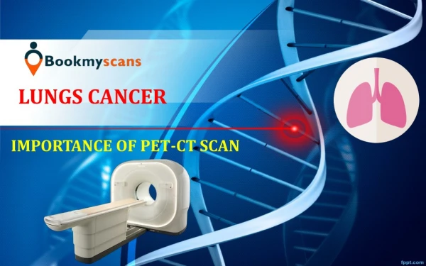 What is PET-CT Scan?? Get a detailed overview & Checkout the real cost of PET-CT Scan