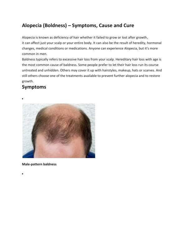 Alopecia (Boldness) â€“ Symptoms, Cause and Cure