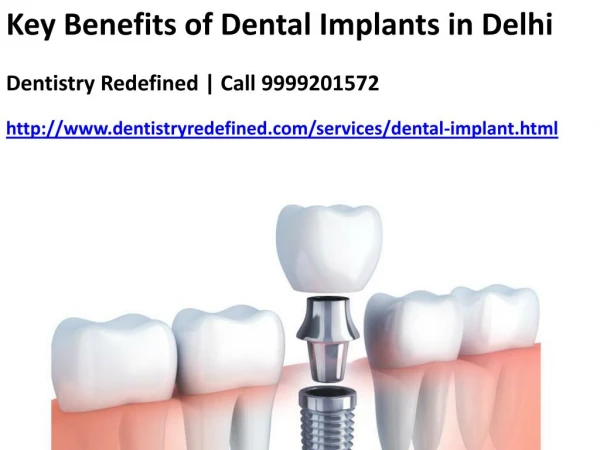 Key Benefits of Dental Implants in Delhi | Dentistry Redefined