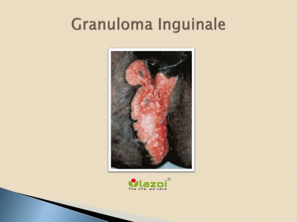 Granuloma Inguinale