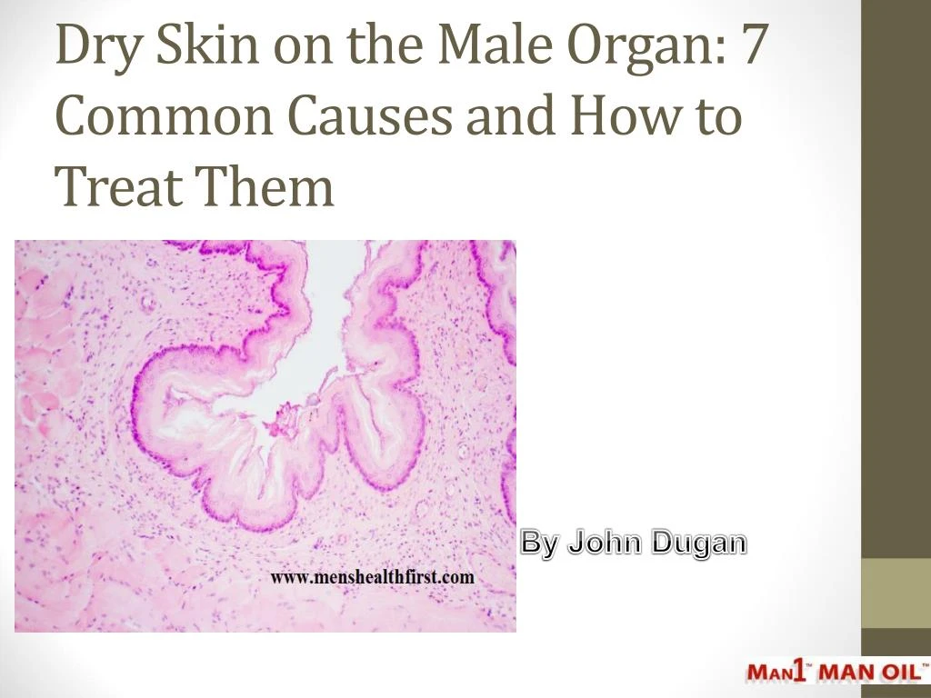 dry skin on the male organ 7 common causes and how to treat them