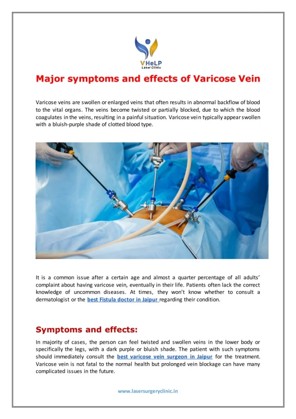 What are some major symptoms and effects of varicose vein