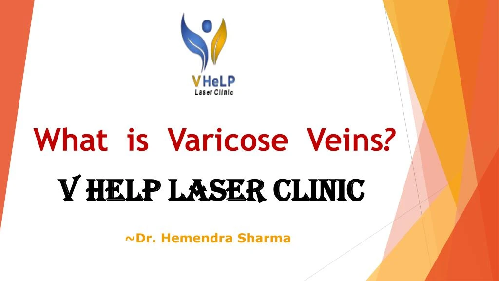 what is varicose veins