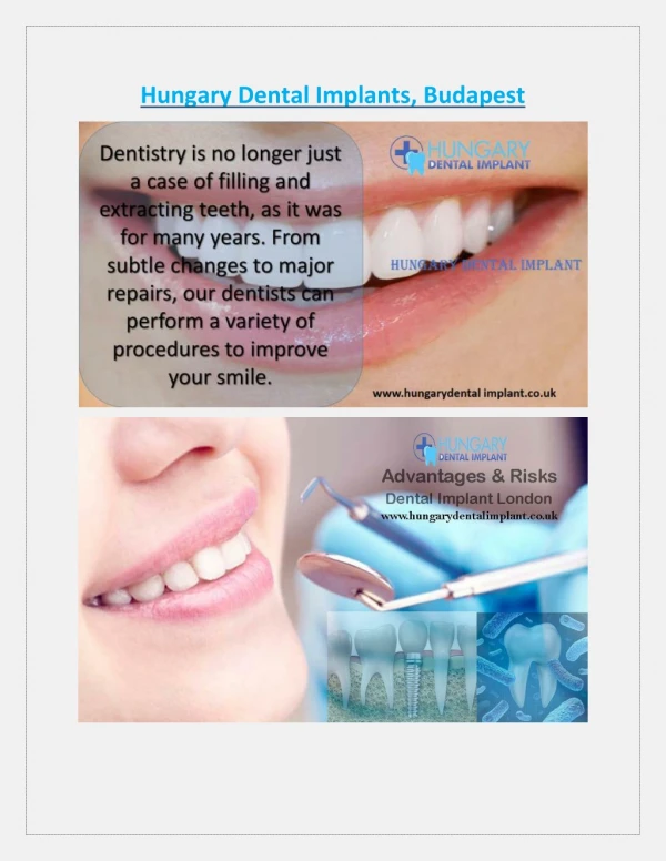 Hungary Dental Implants, Budapest