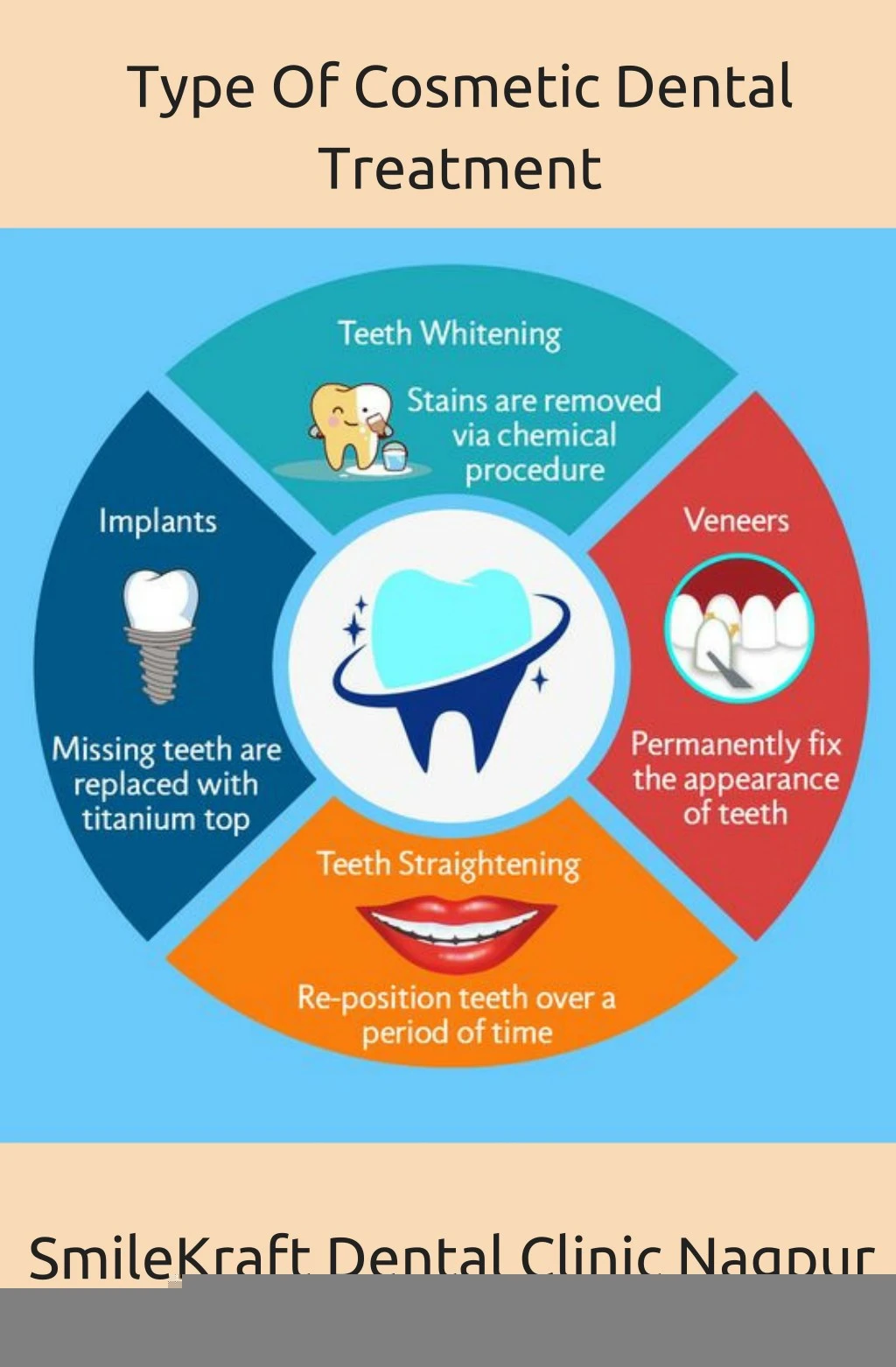 type of cosmetic dental treatment