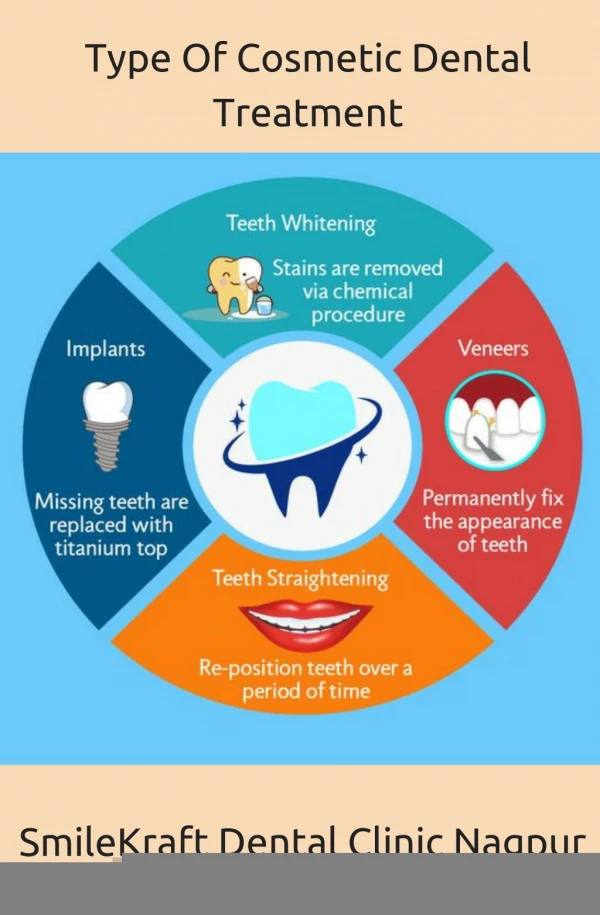 Type of cosmetic Dental Treatment