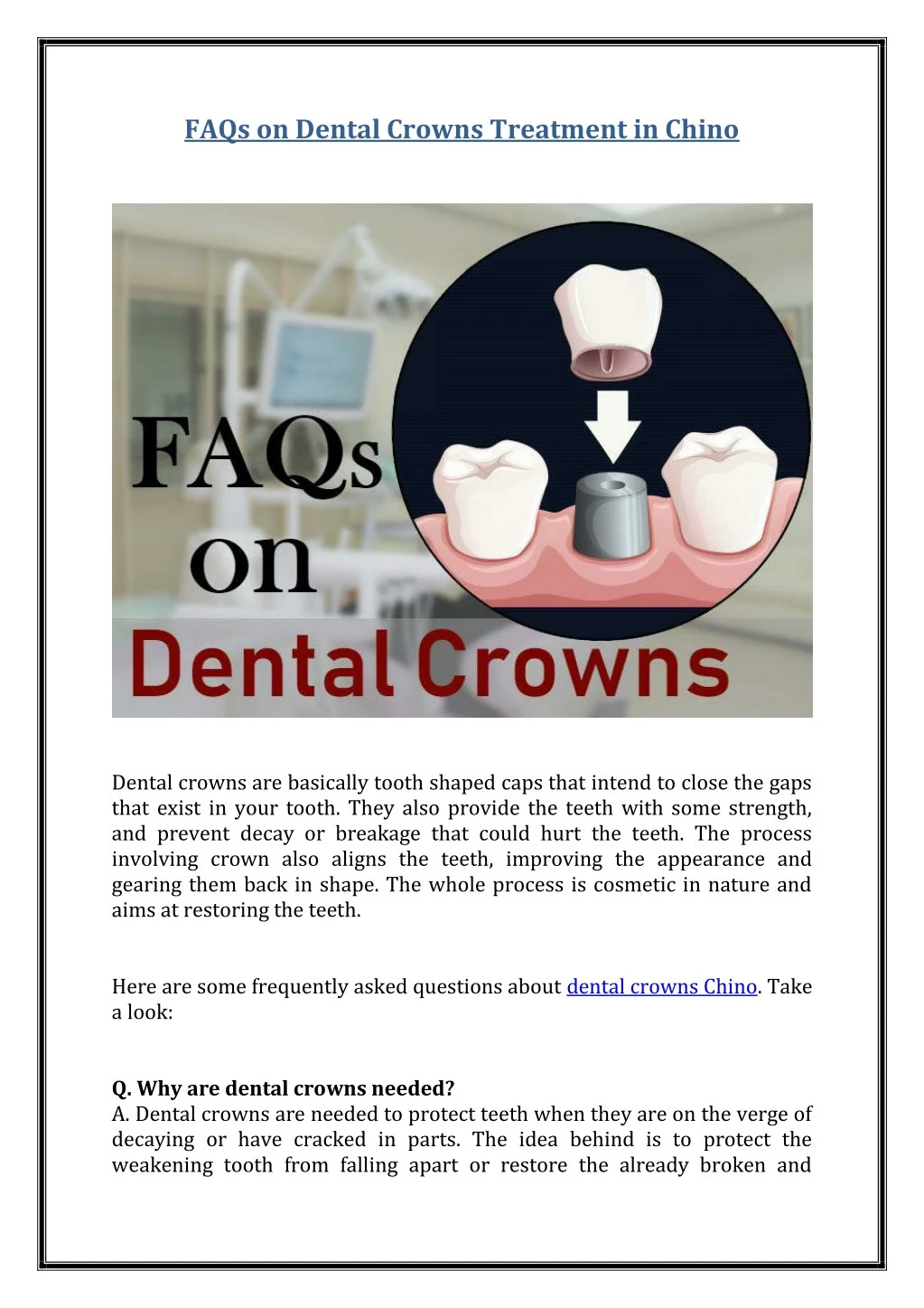 faqs on dental crowns treatment in chino