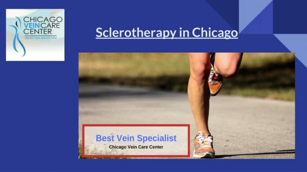 Best Sclerotherapy in Chicago | Yourveinexpert