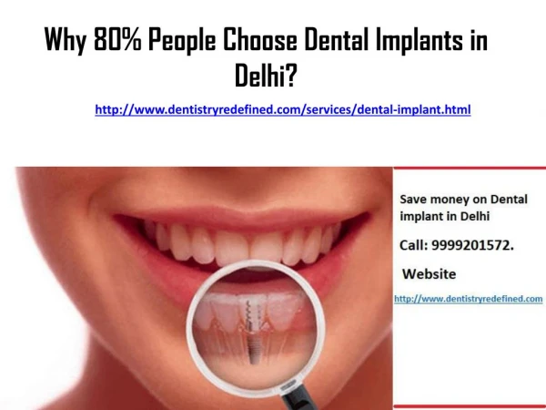 Why 80% People Choose Dental Implants in Delhi?